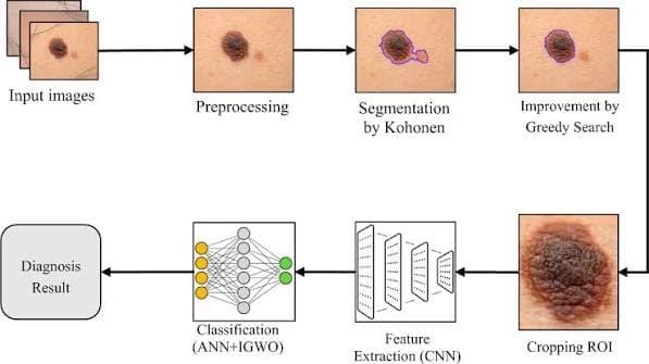 Melanoma Skin Cancer